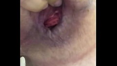 Anal Fisting 2 Gape Thumb