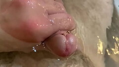 Morbosidad Thumb