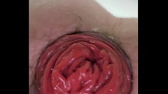 Gaping and Rosebud Thumb
