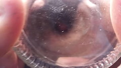 Botella anal Thumb