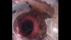 Botella anal 2 Thumb