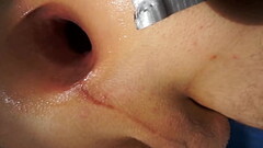 My first anal dildo fuck close up Thumb