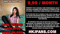 Huge XO speculum open to the max anal hole of Hotkinkjo. Anal fisting &amp_ deep anal view!!! HKJFAN Thumb
