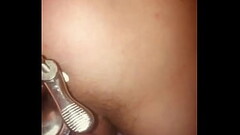 Rectal wall injection Thumb