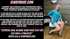 Extreme anal blonde Sindy Rose fist her ass hole &amp_ prolapse Thumb