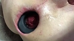TRYING OUT MY NEW ANAL EXPANSION RING PART 1 Thumb