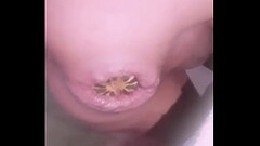 Anal Xtreme insertion vegetal Thumb