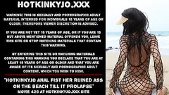 Hotkinkyjo anal fist her ruined ass on the beach till it prolapse Thumb