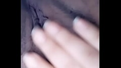. Thumb