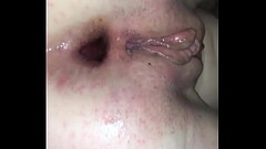 Anal gaping the wife Thumb