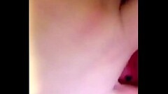 Helen Keller Thumb