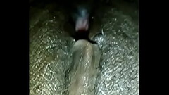 My step fathers Thumb