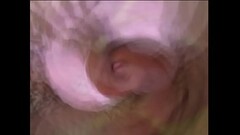 EP-HCVDVX0498-273 Thumb