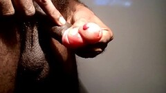 PENIS PUMP ACCIDENT b. BUBBLE.OVERPUMPING SAFETY PRECAUTIONS ADVISED Thumb