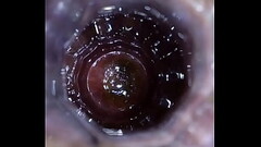 assvase inside Thumb