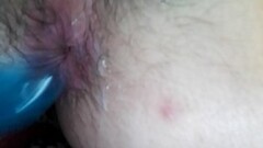 Anus fish Thumb